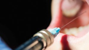بی حسی دندانپزشکی برای چه افرادی ممنوع است؟