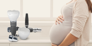 آشنایی با ایمپلنت در دوران بارداری