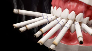 تاثیر سیگار بر دندان