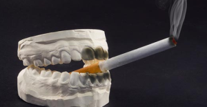 دندان مصنوعی و سیگار