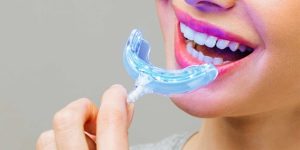 معرفی انواع روش های زیبایی دندان